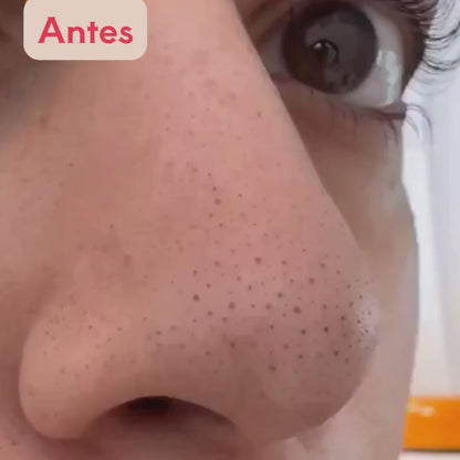 Mascarilla Anti Puntos negros
